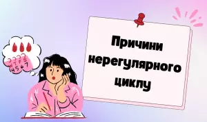 Інфографіка, що викладає загальні причини нерегулярних менструальних циклів.